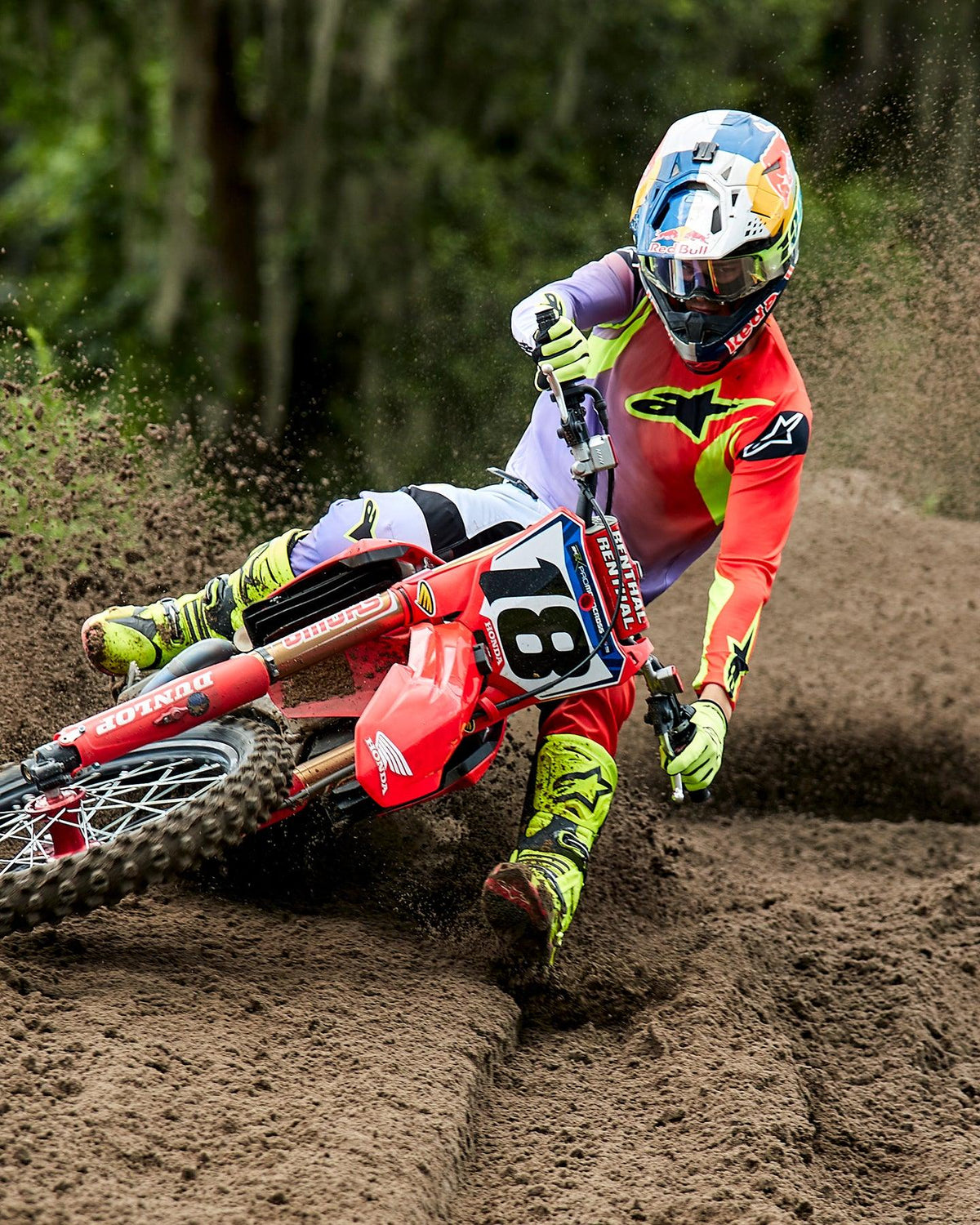 MX24 Gear Sets