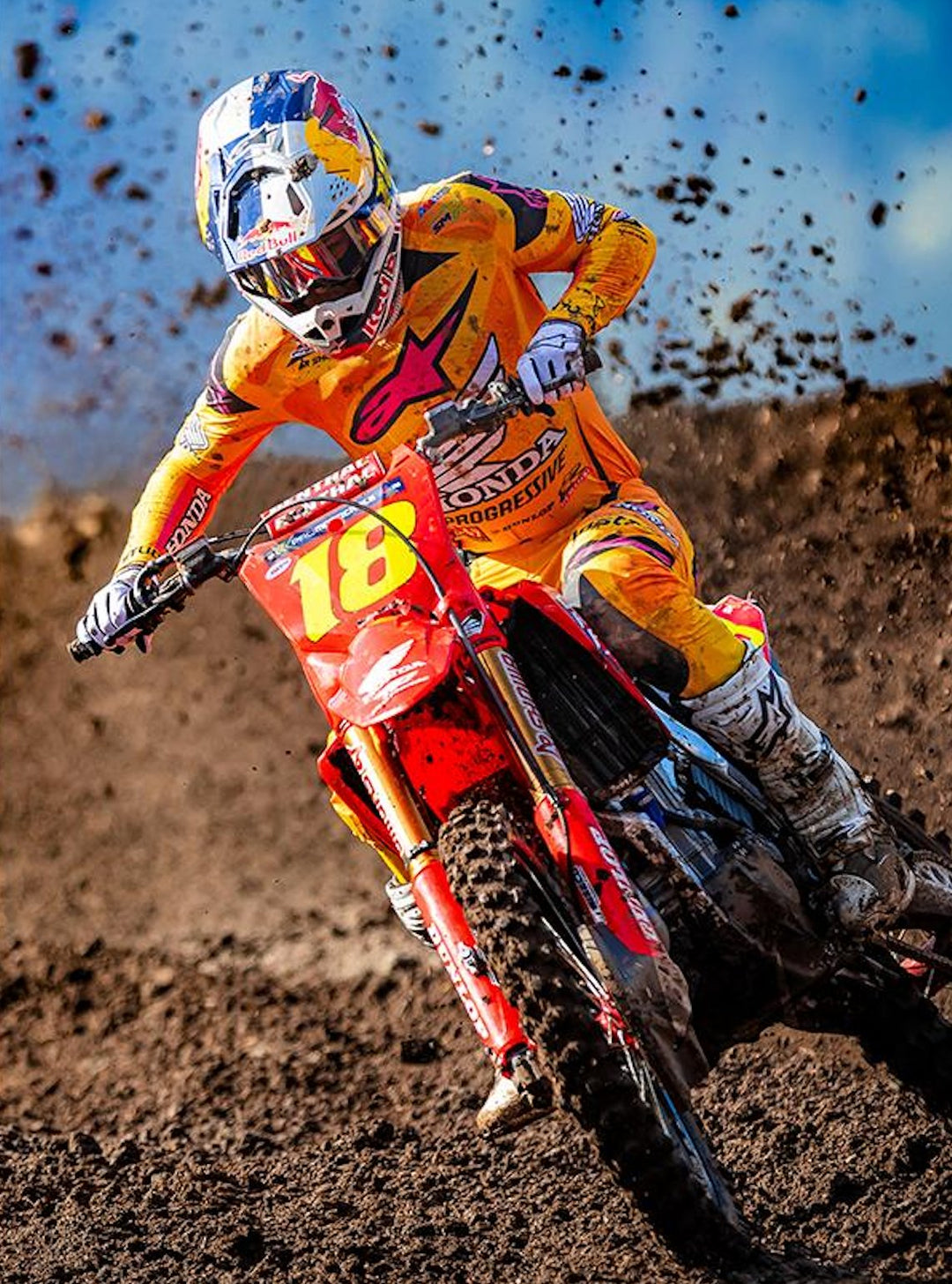 MX